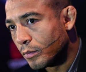 Jose Aldo scarred face and ear